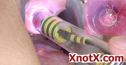Peehole play urethral sounding endoscope / 26-03-2020 [HD/720p/MP4/797 MB] by XnotX